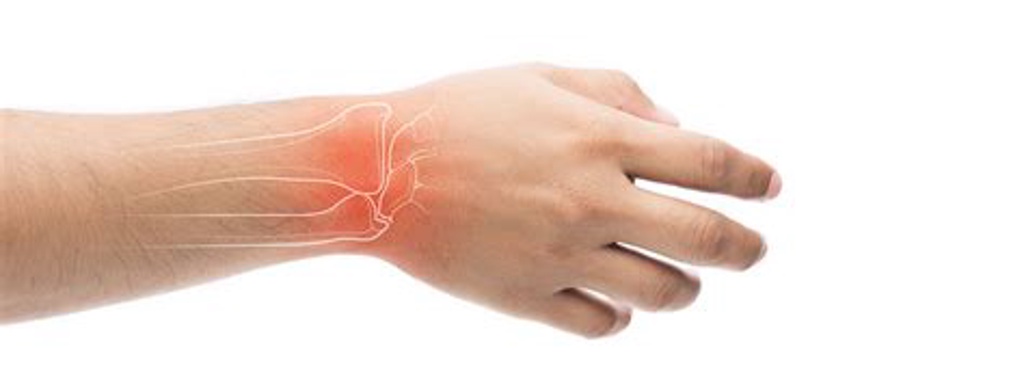 Managing Wrist Pain Managing Wrist Pain